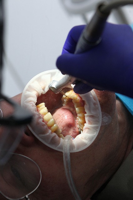 bělení zubů
